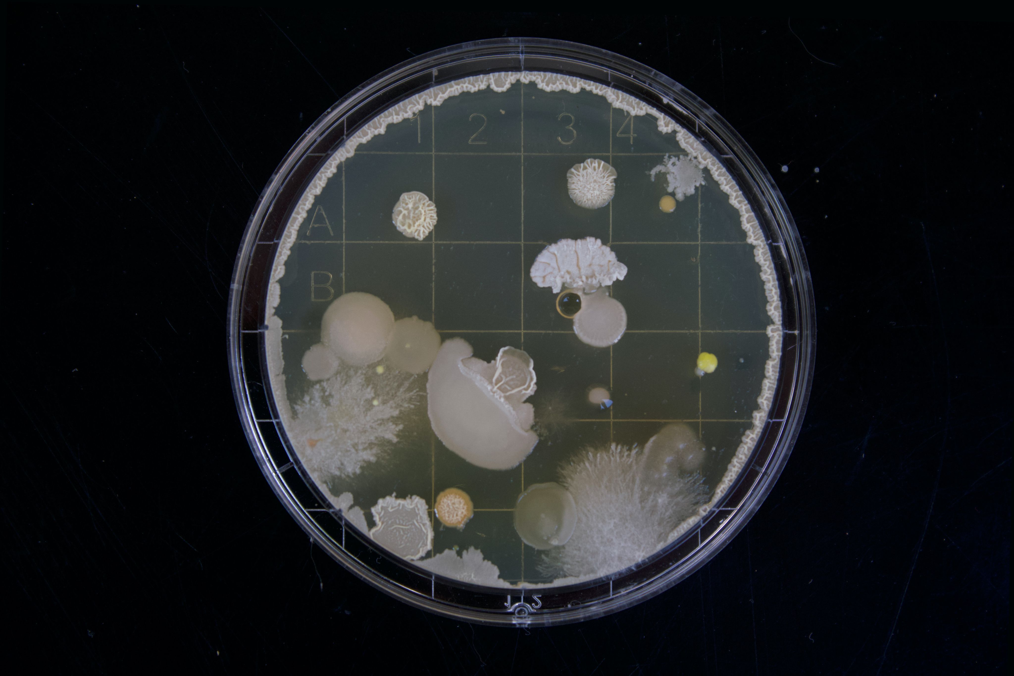 An image of a petri dish with cultures of bacteria growing on it